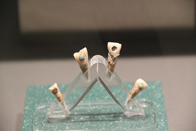 A new study has found that Ancient Mayan glue used to stick gemstones to their teeth could have prevented tooth decay and infections.