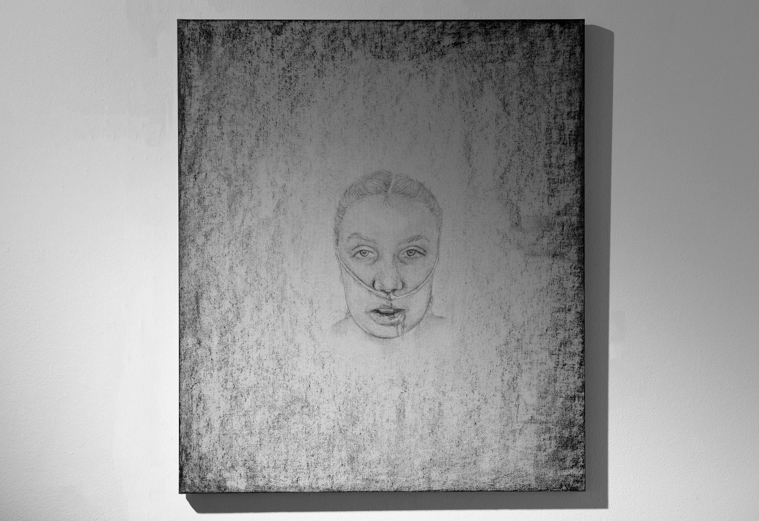'I found peace in the practice of art': After relentless bullying pushed her to get double jaw surgery, Danielle Paterson, a fine art graduate, discusses how and why she documented her experience through art. 