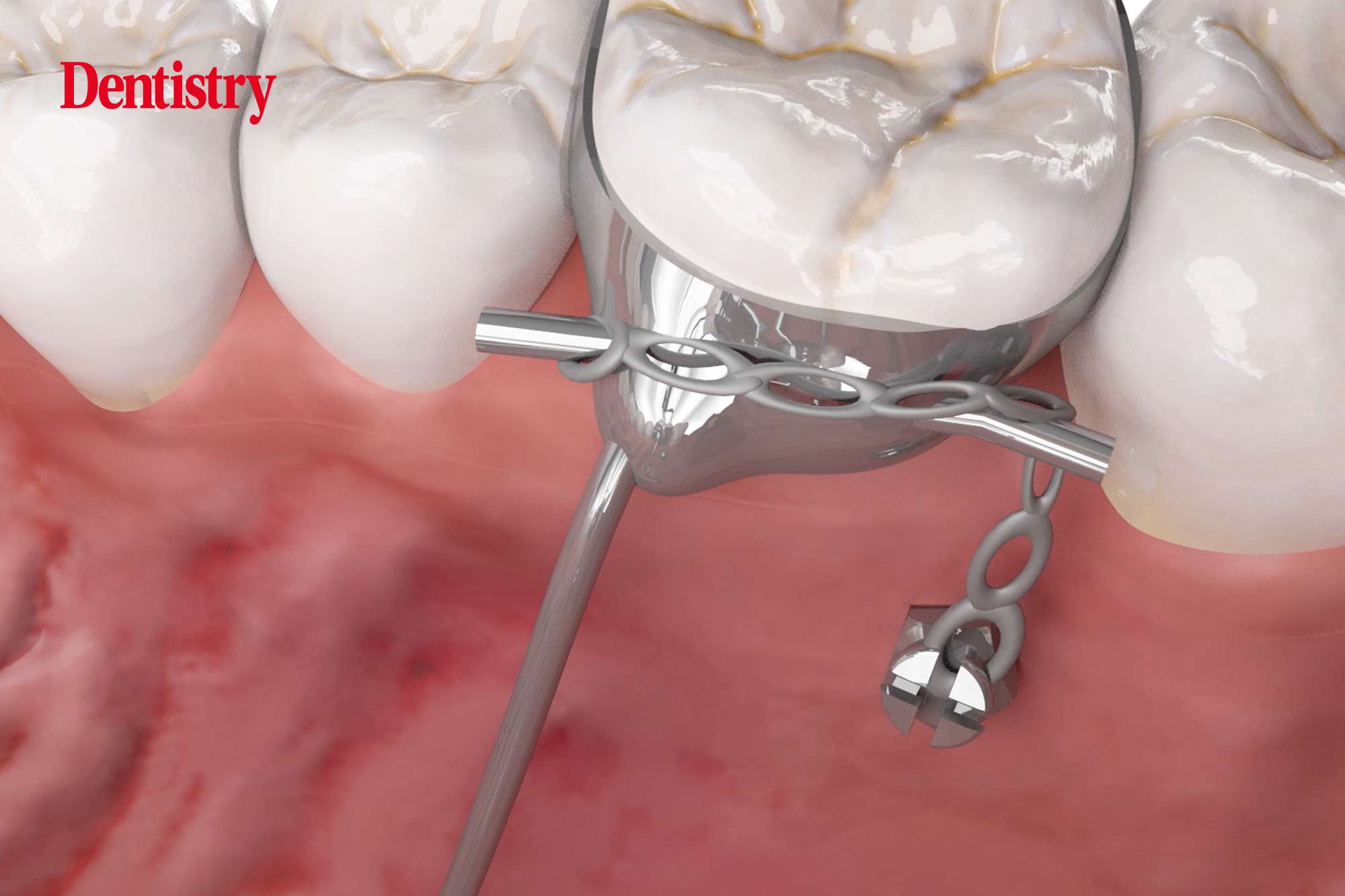 My top four orthodontic must-haves