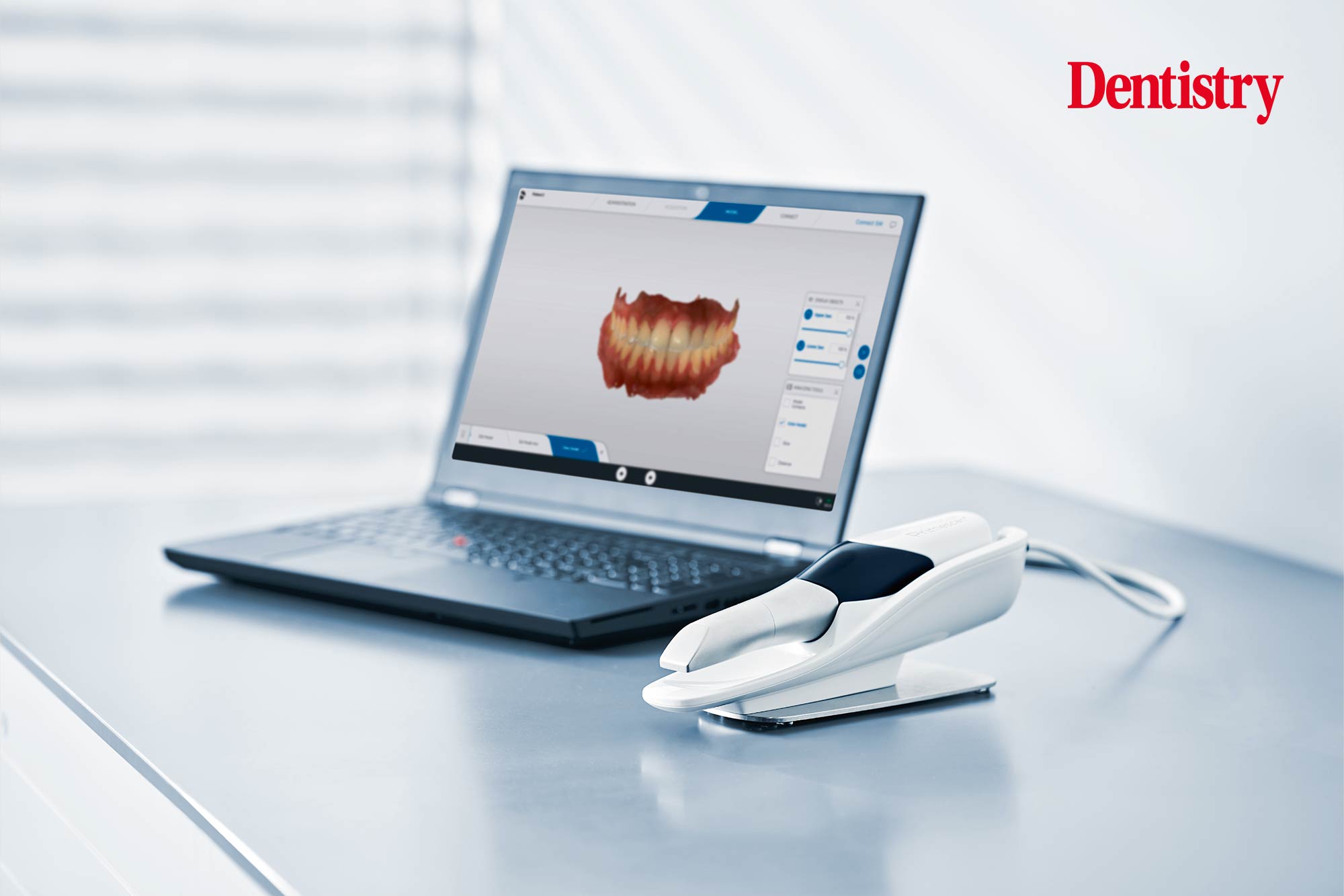 Primescan is on the move: portable and powered by DS Core