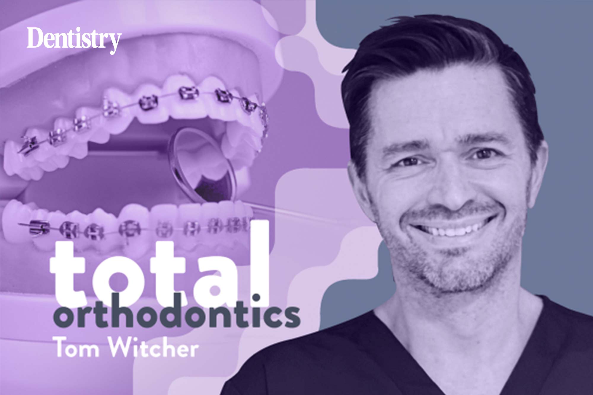 With a degree in psychology, Tom Witcher, a specialist orthodontist at Total Orthodontics Haywards Heath, part of Bupa Dental Care, discusses body dysmorphia and its significance in dentistry, including how to identify it and approach it with sensitivity.