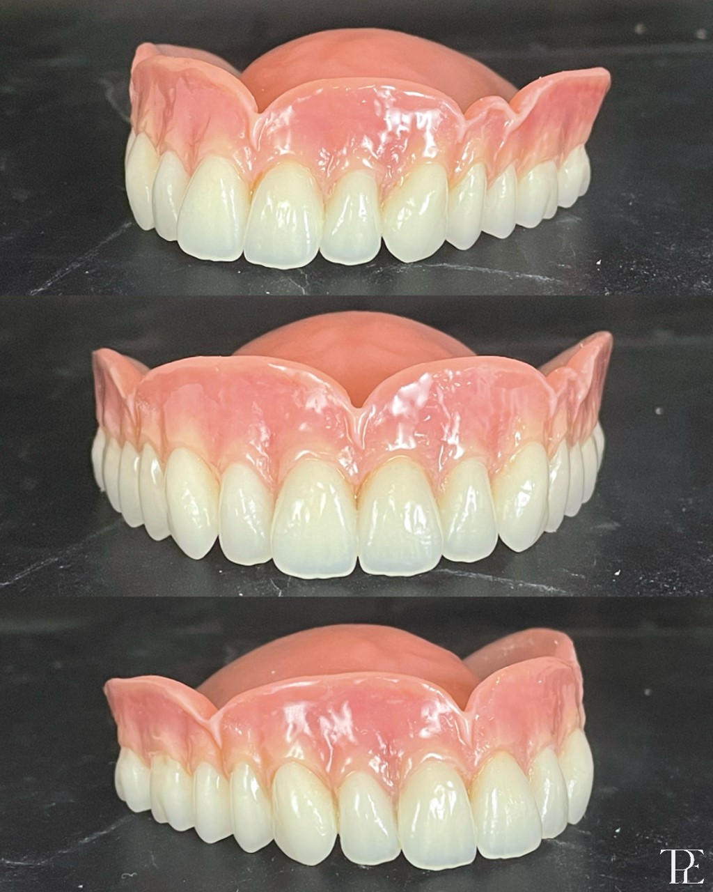 Beth Brown discusses her journey to becoming a dental technician and how she keeps her passion alive. 
