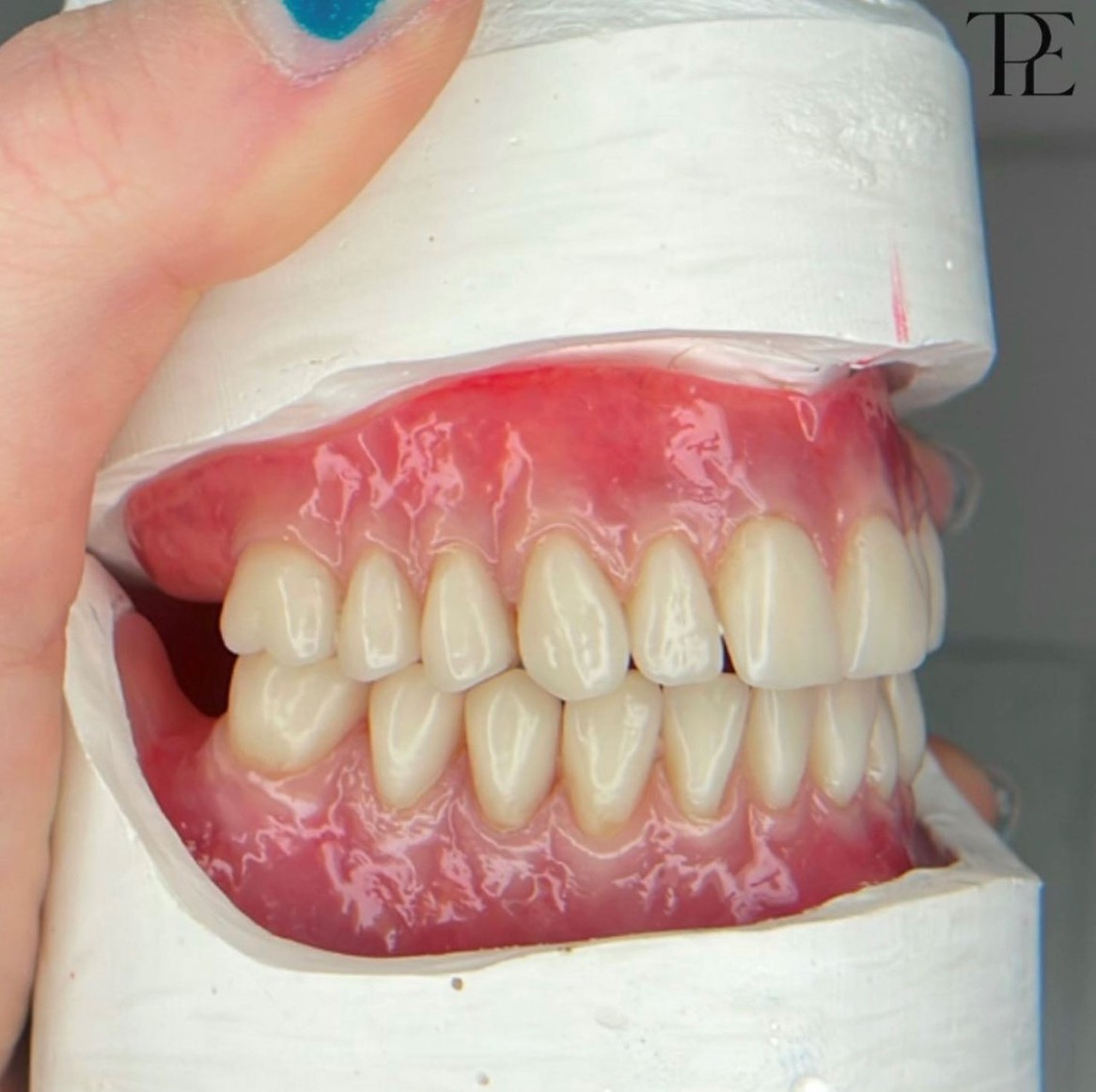 Beth Brown discusses her journey to becoming a dental technician and how she keeps her passion alive. 