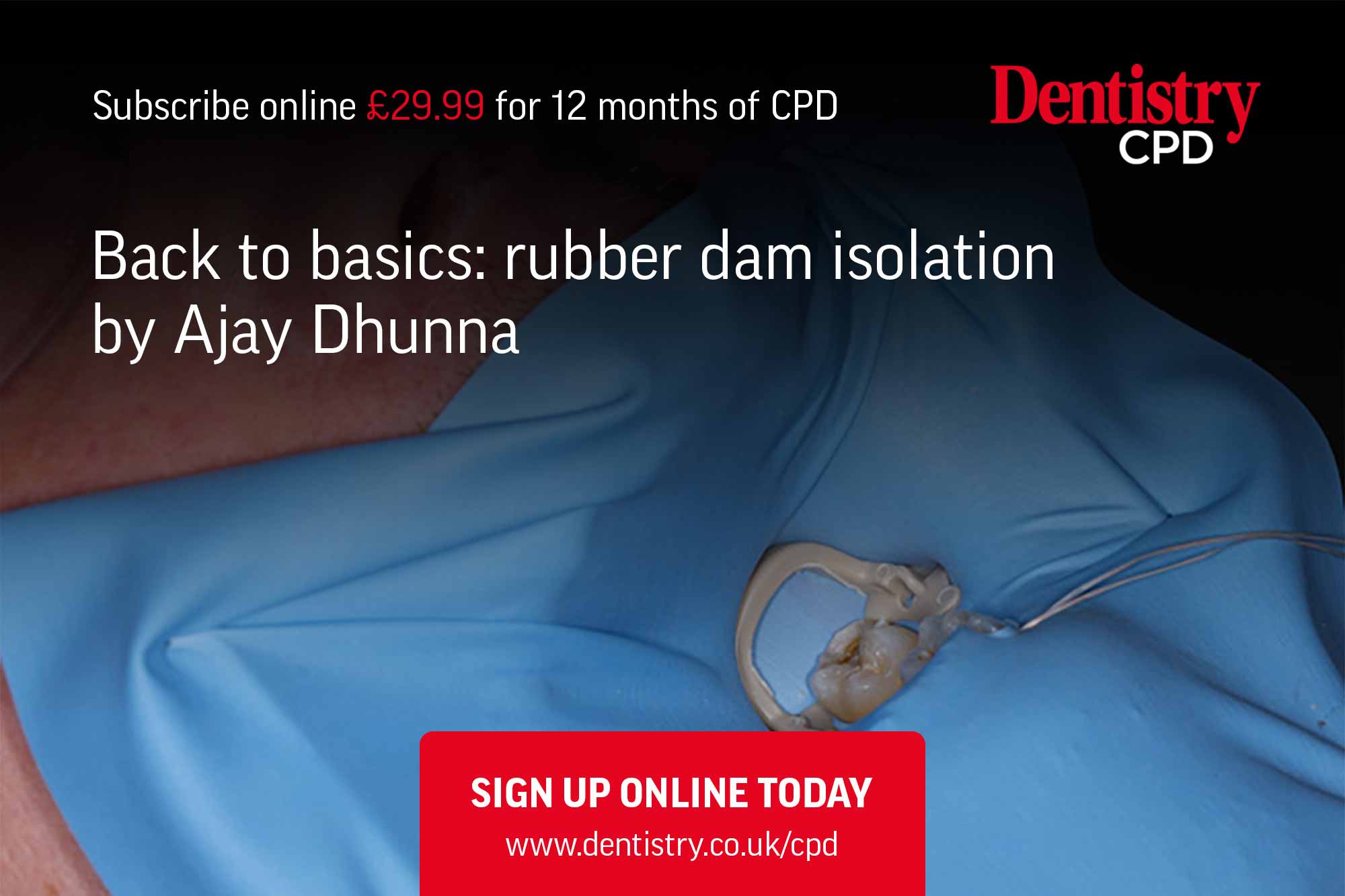 rubber dam