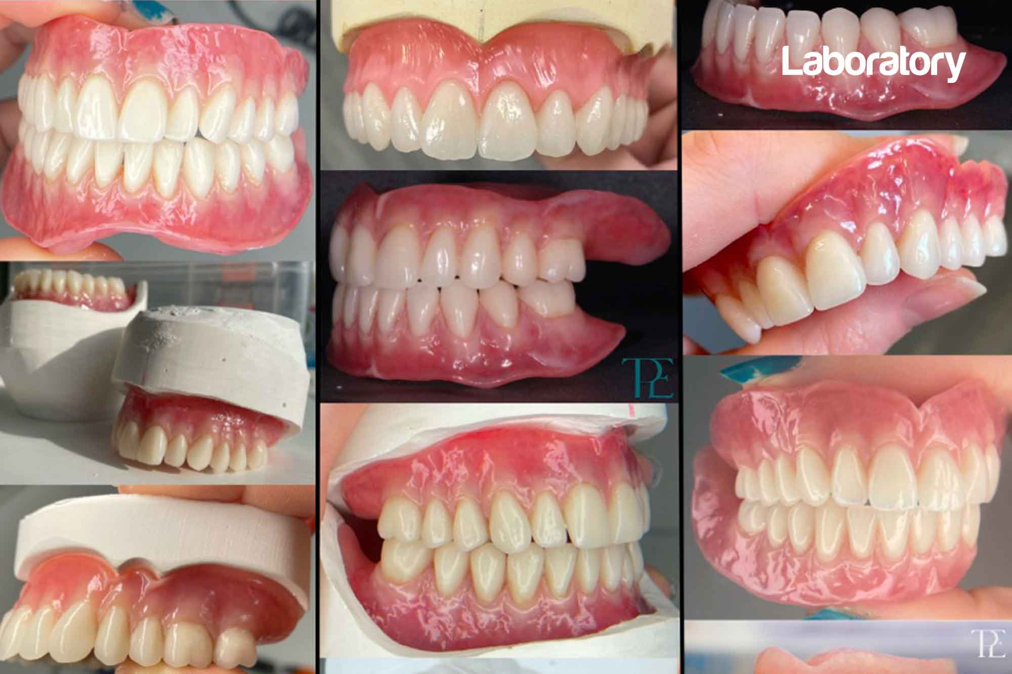 Beth Brown discusses her journey to becoming a dental technician and how she keeps her passion alive. 