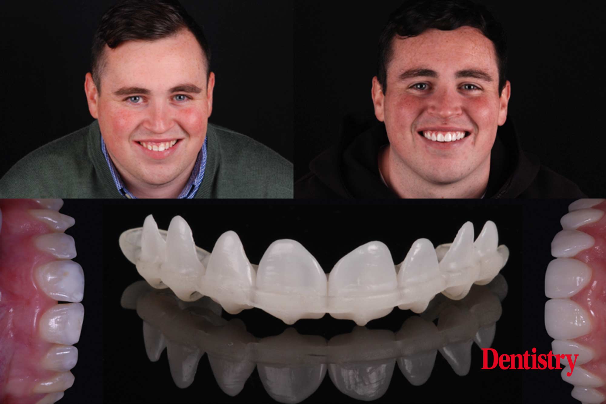 First Fit – showing what is possible in digital dentistry