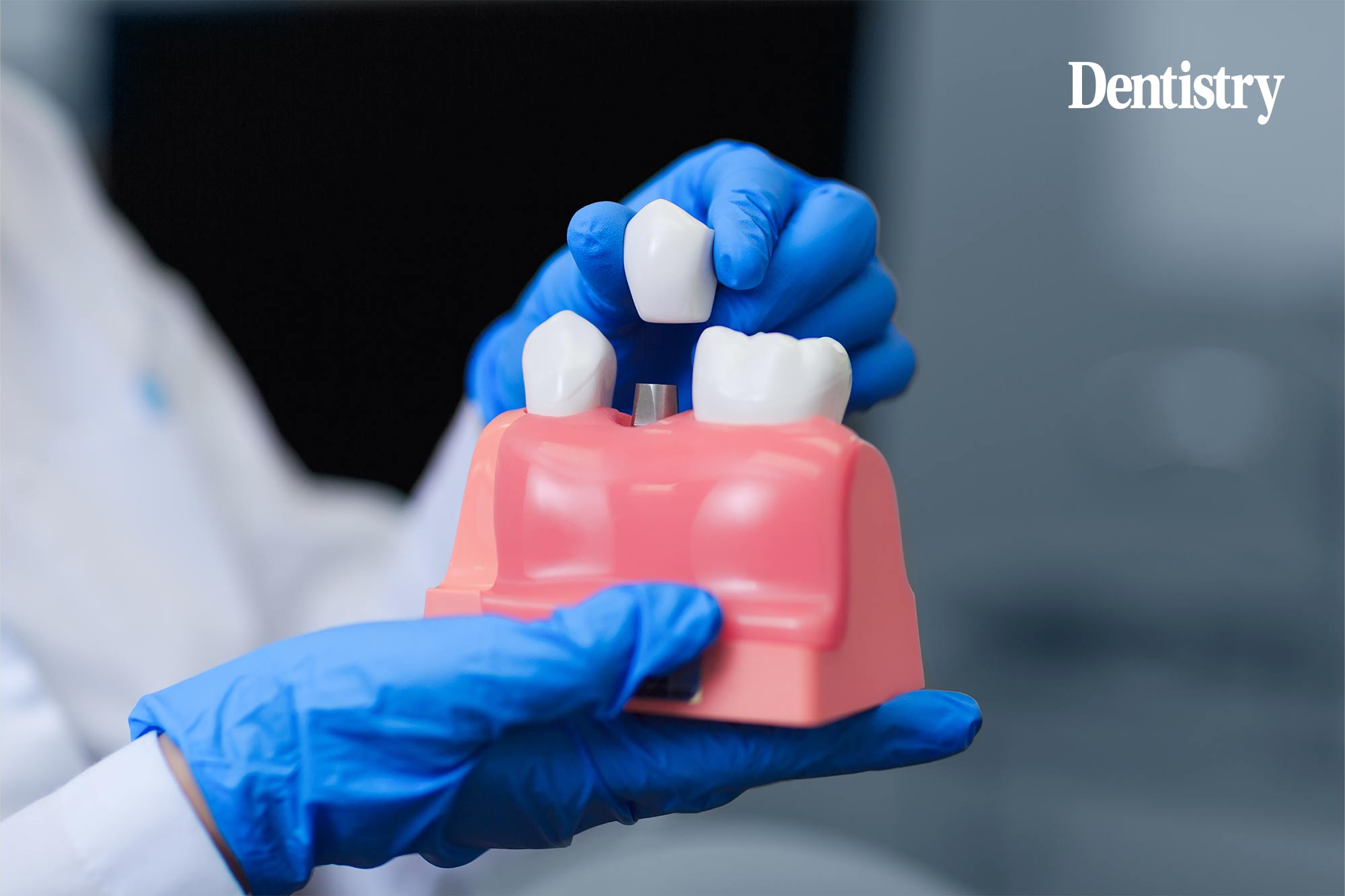 Three reasons why it might be time to switch your implant provider