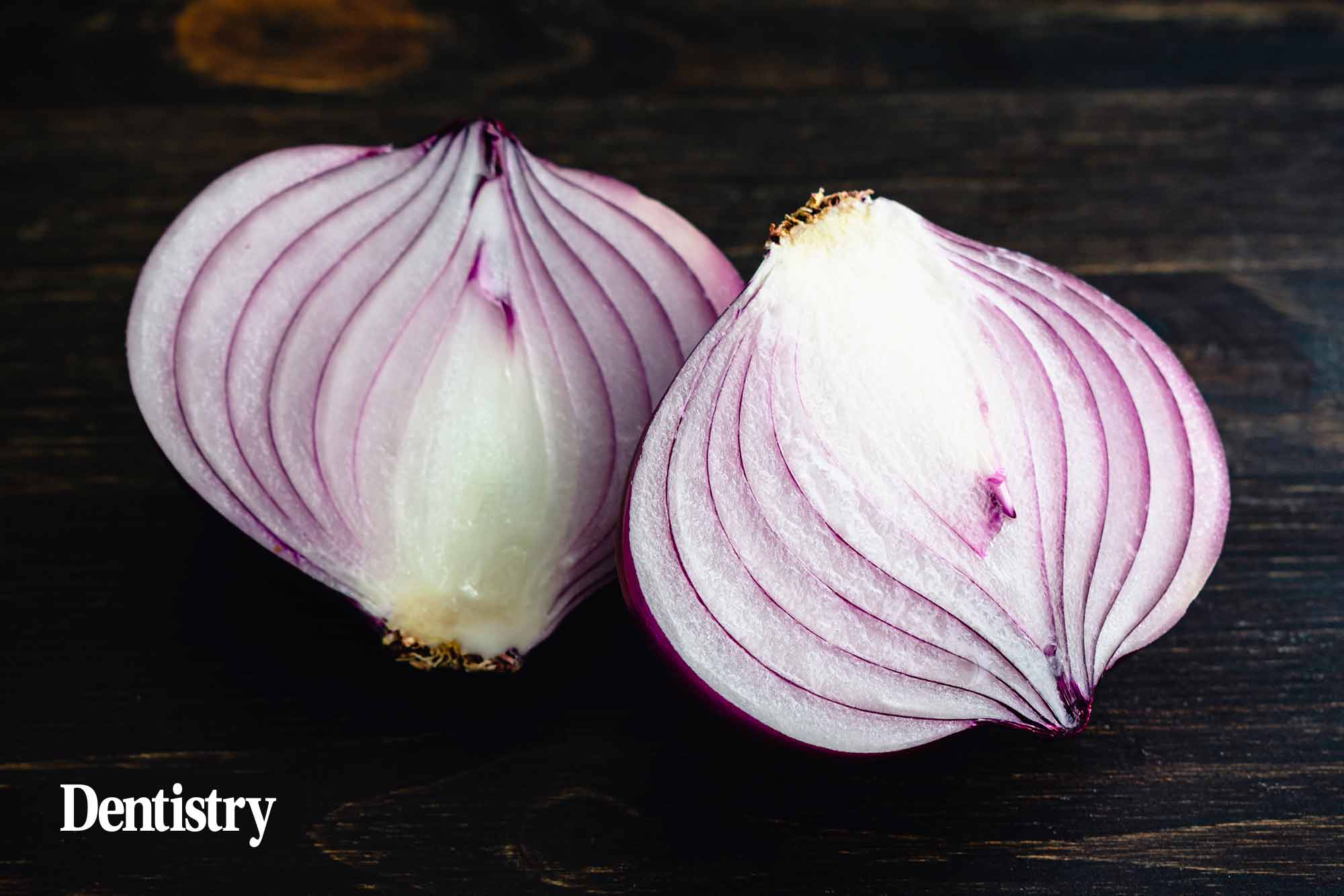 This month, Jamie Morley discusses why peeling back the layers of a person allows you to understand and connect with your team.