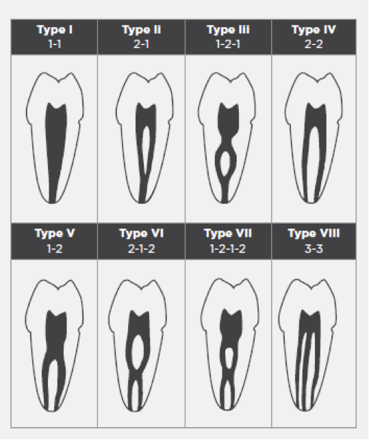 Dr Matthew R Miller presents an introduction to his white paper focusing on the management of complex root canal anatomy, comparing Kerr’s Zenflex file system with two other popular systems.