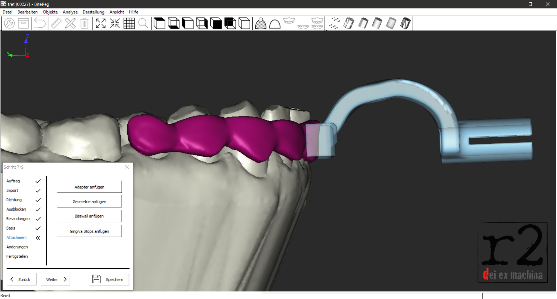 Auxiliary digital parts – 3D printing and its possibilities