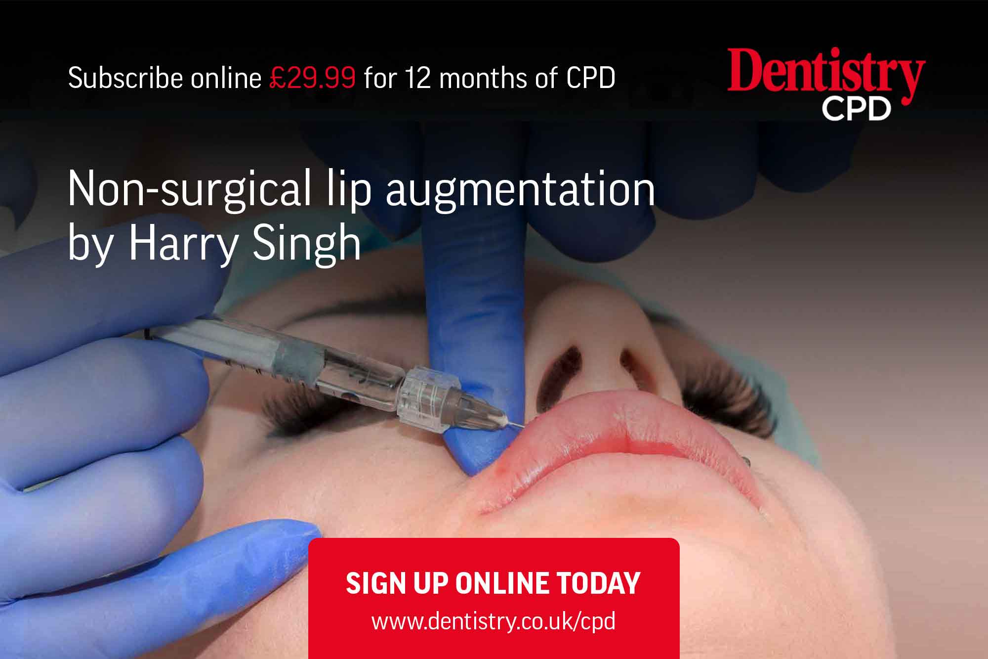 Lip surgery
