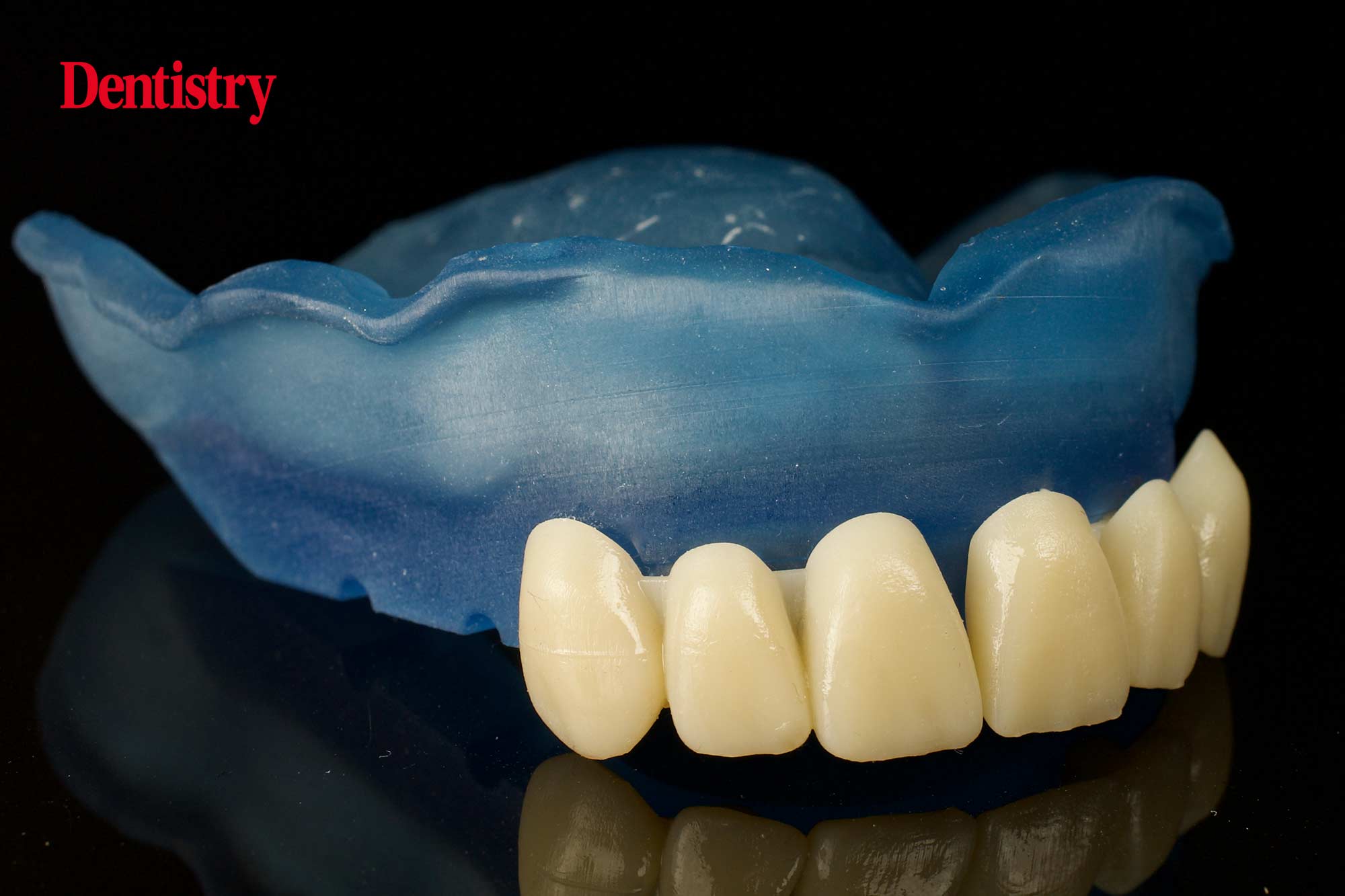 Auxiliary digital parts – 3D printing and its possibilities