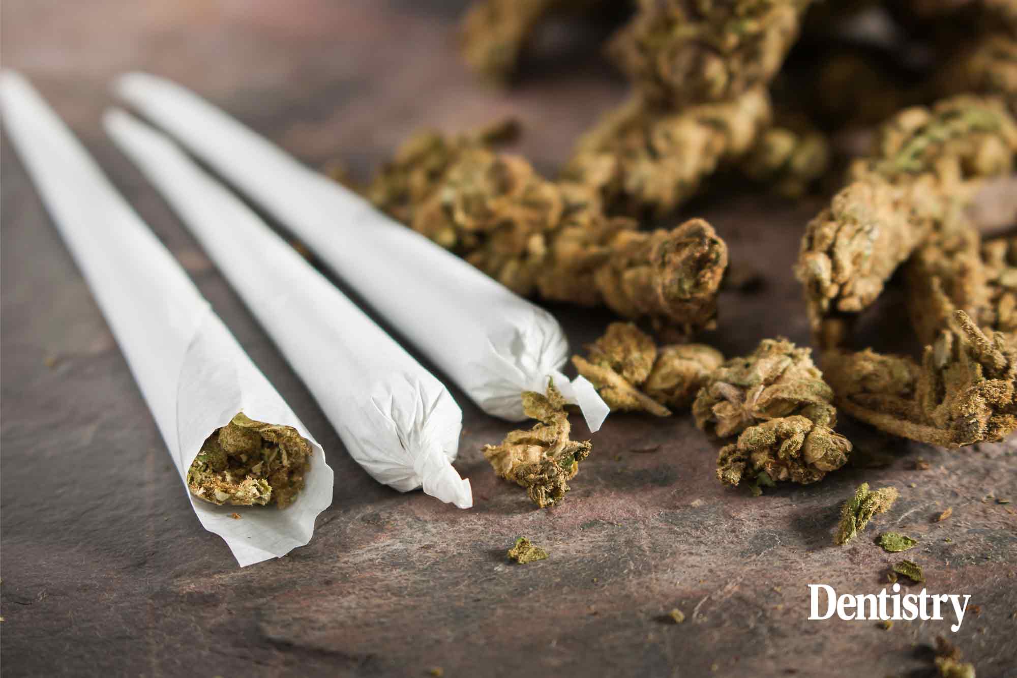 Half of dentists say patients are high on marijuana at dental appointments