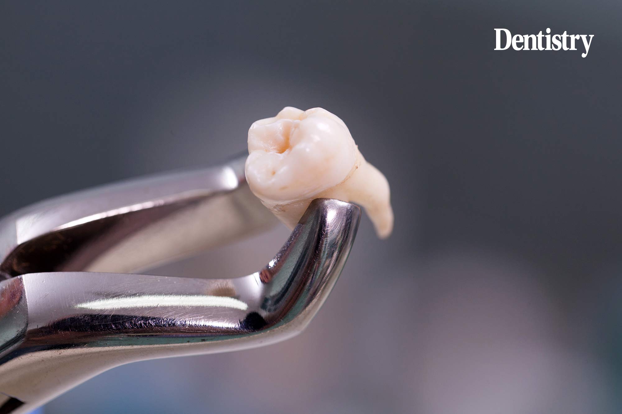 Avoid the pain of an extraction claim