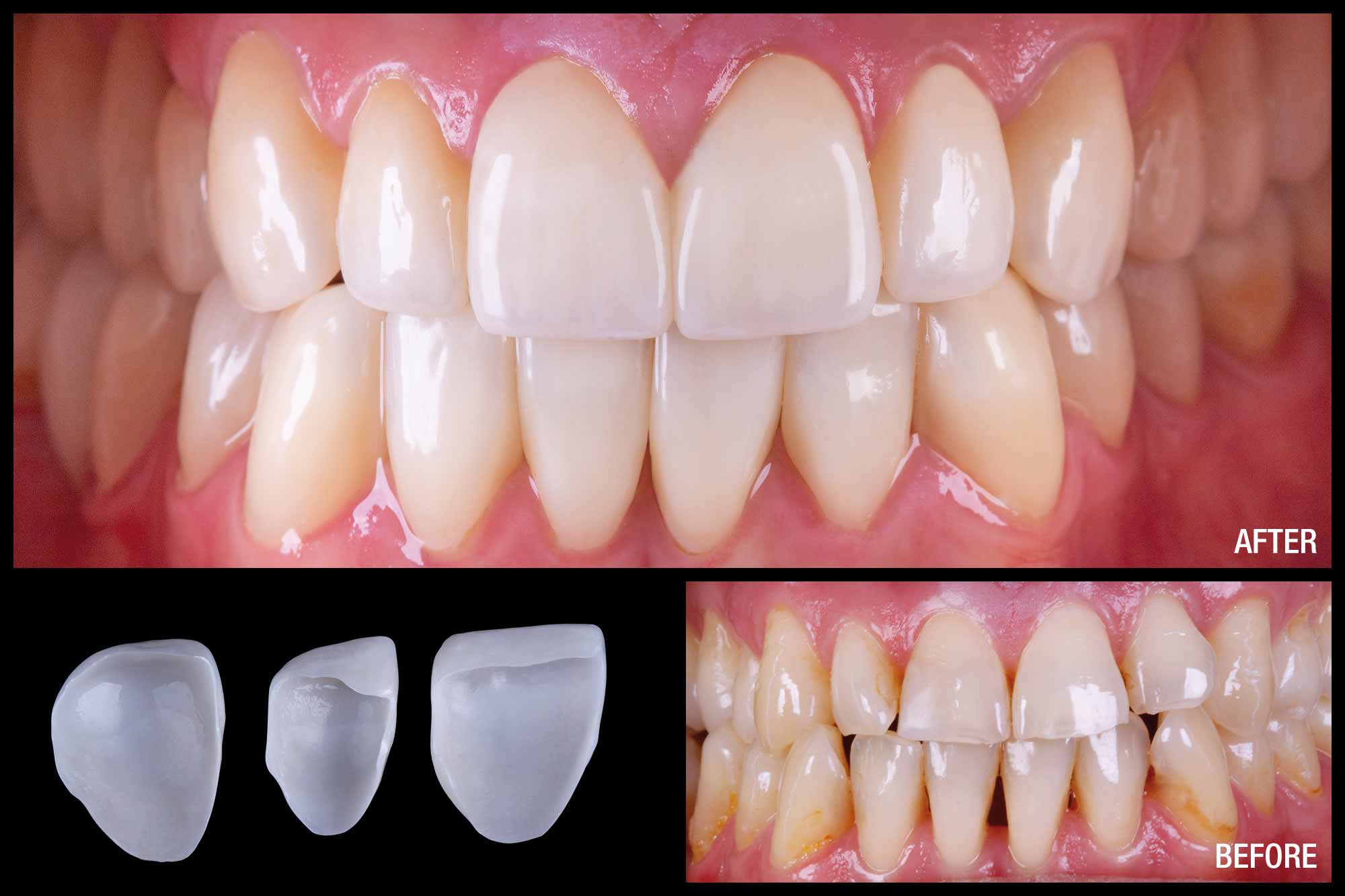 Ultimate aesthetics – connected solutions, from prepping to rechecking