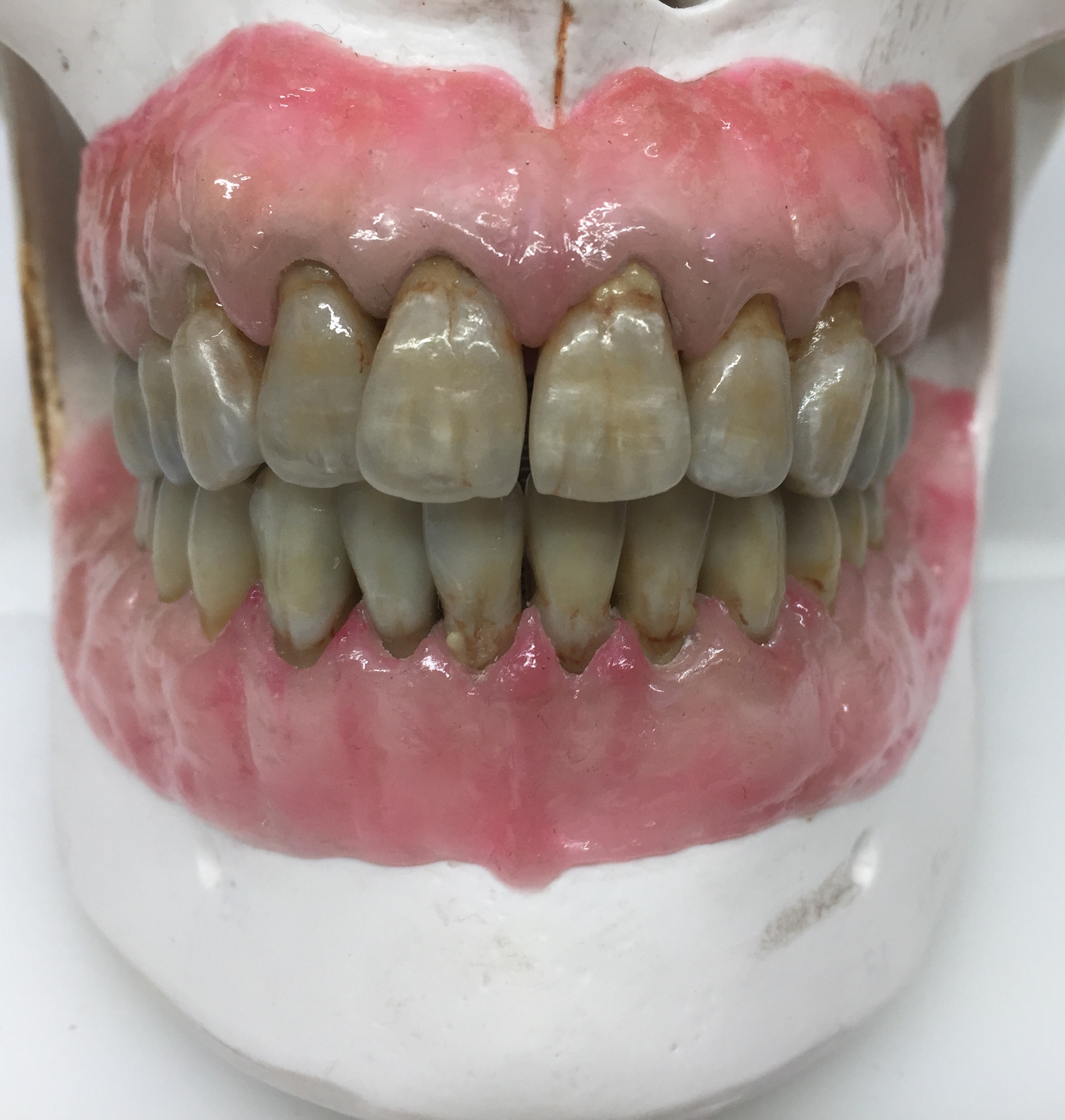 Stephen Vincent discusses his journey into dental technology, his plans to open a new laboratory, and his latest project involving reconstructing the dentition of a human skull.