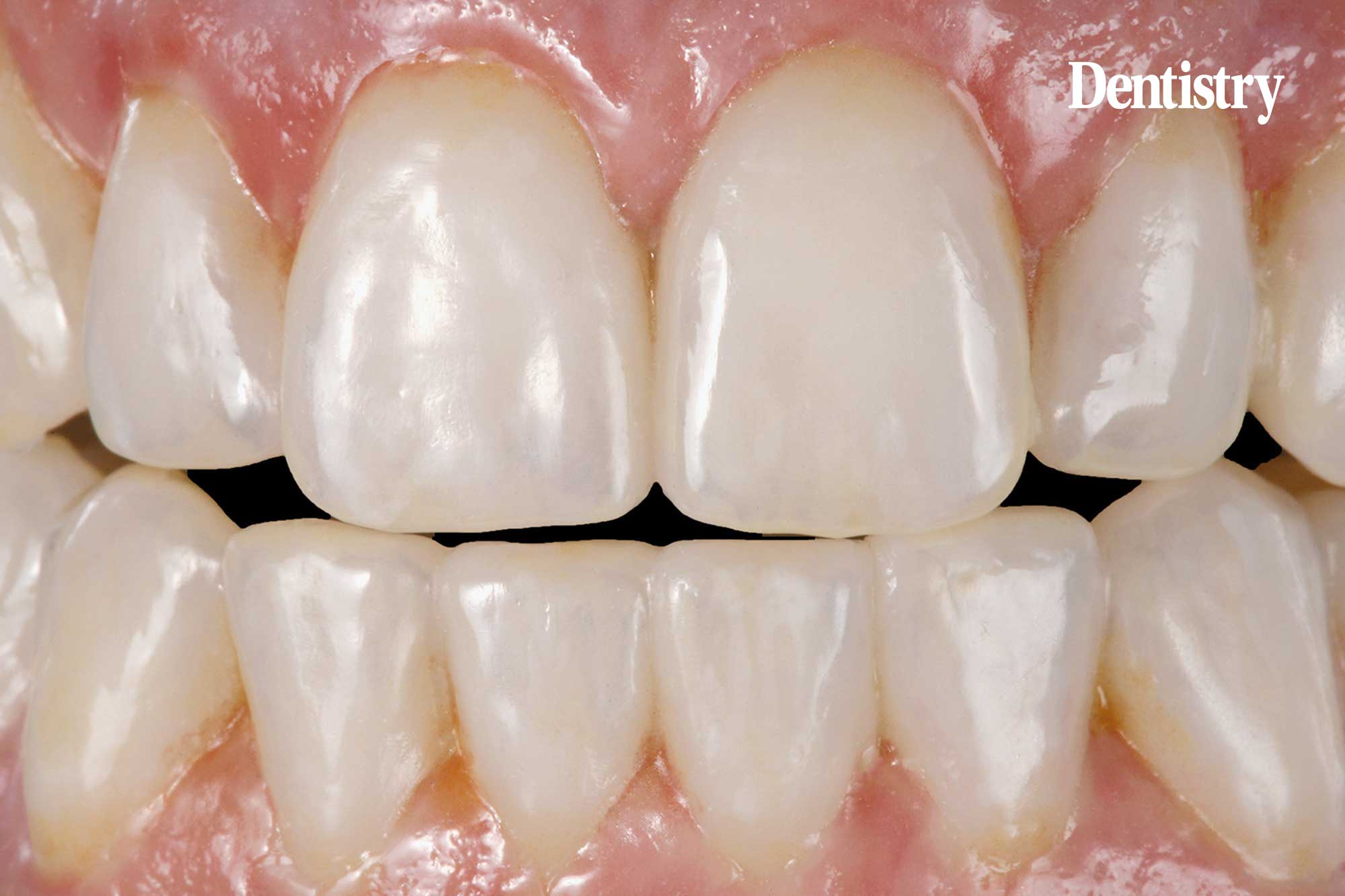 Prettau 2 Dispersive: zirconia with natural colour gradient 