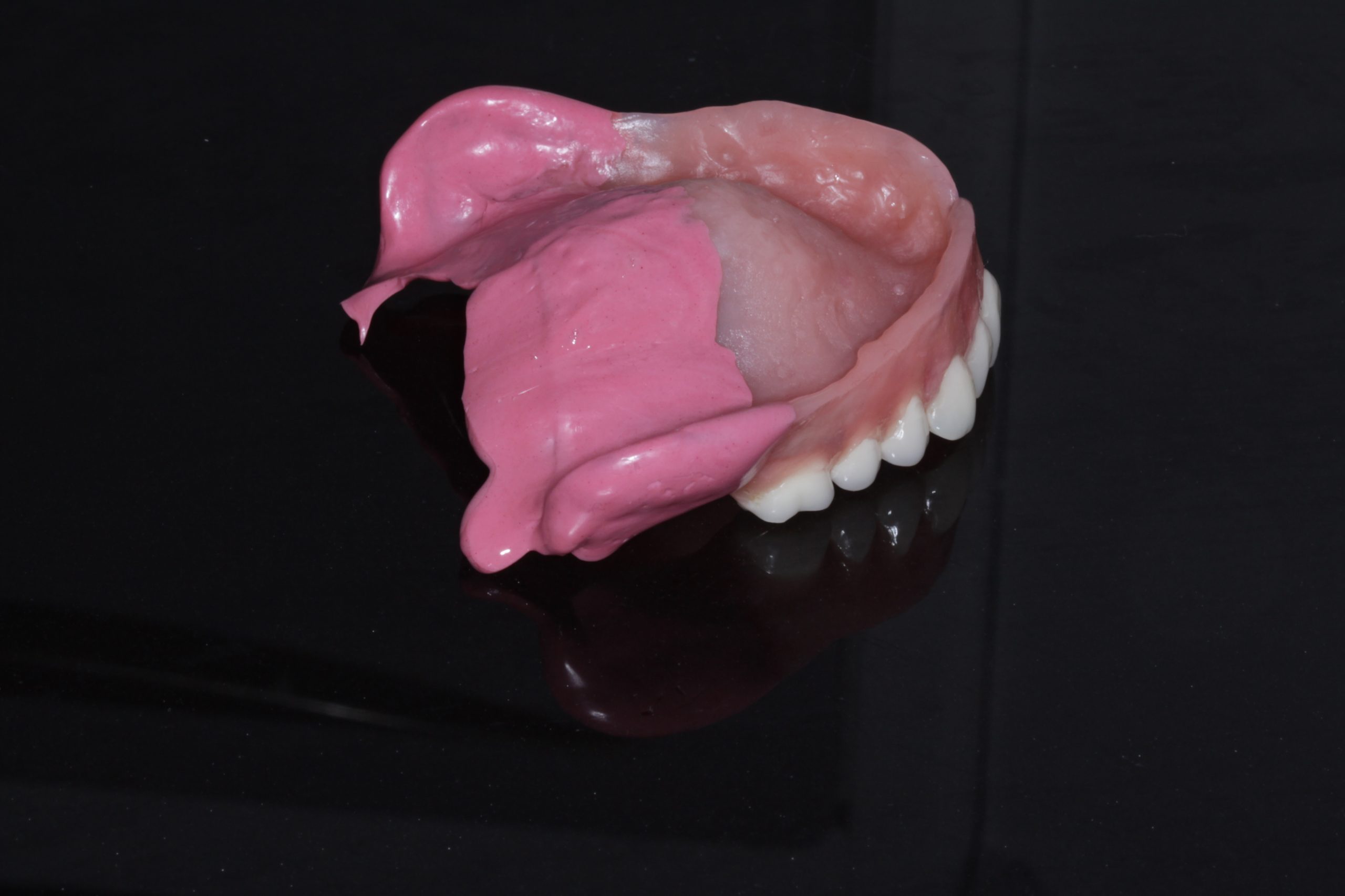 Many people find dentures to be a challenging part of their work. But since they aren't going away for the foreseeable future, dentist and qualified dental technician, Paul Middleton, gives his advice for improving your denture work.