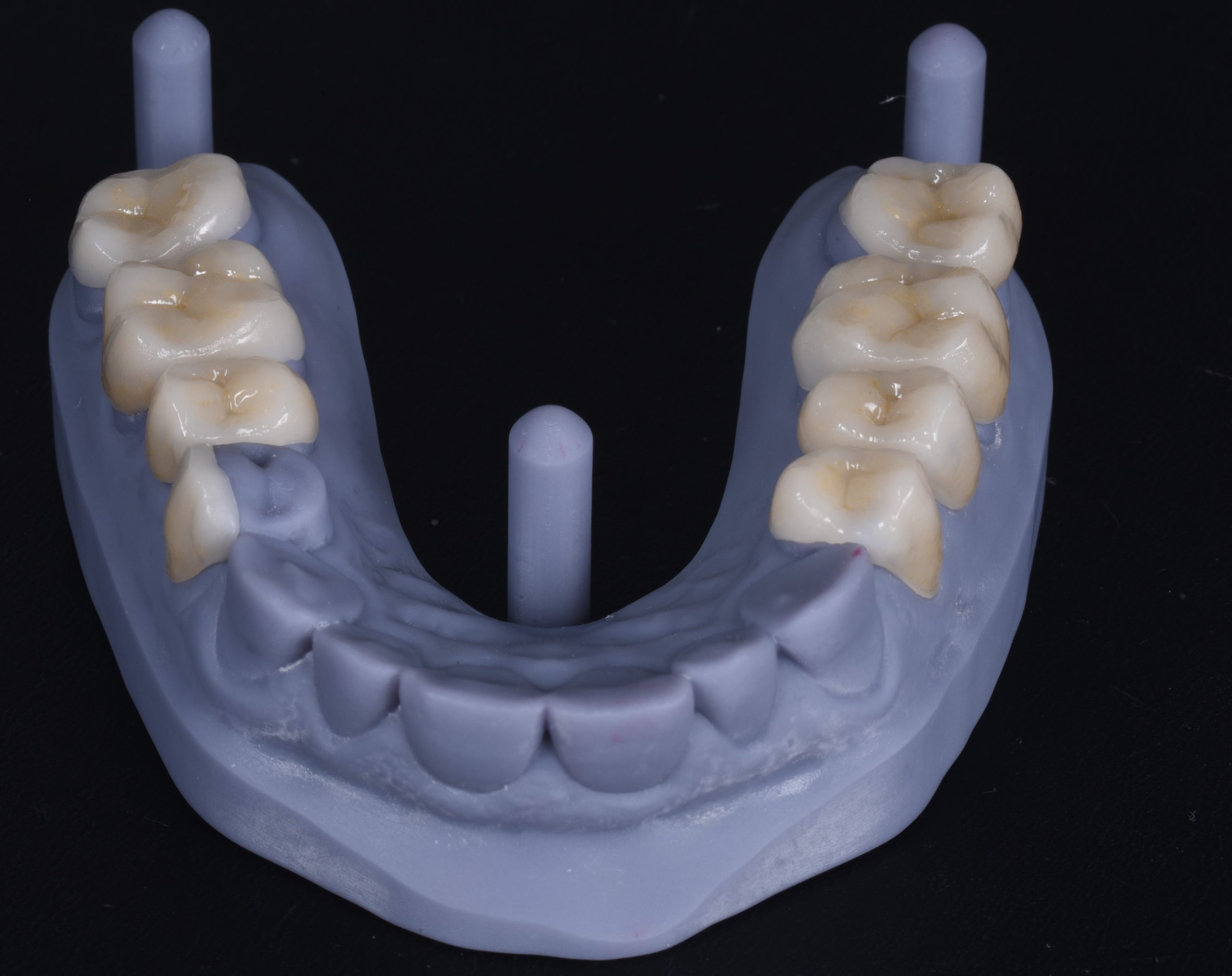 Figure 5.VDO Augmentation