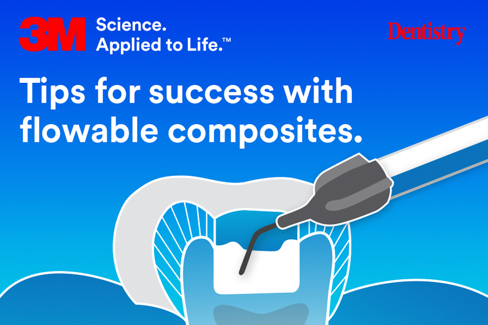 Illustration of a prepared tooth being filled with flowable composites over a blue gradient with 3M Science.