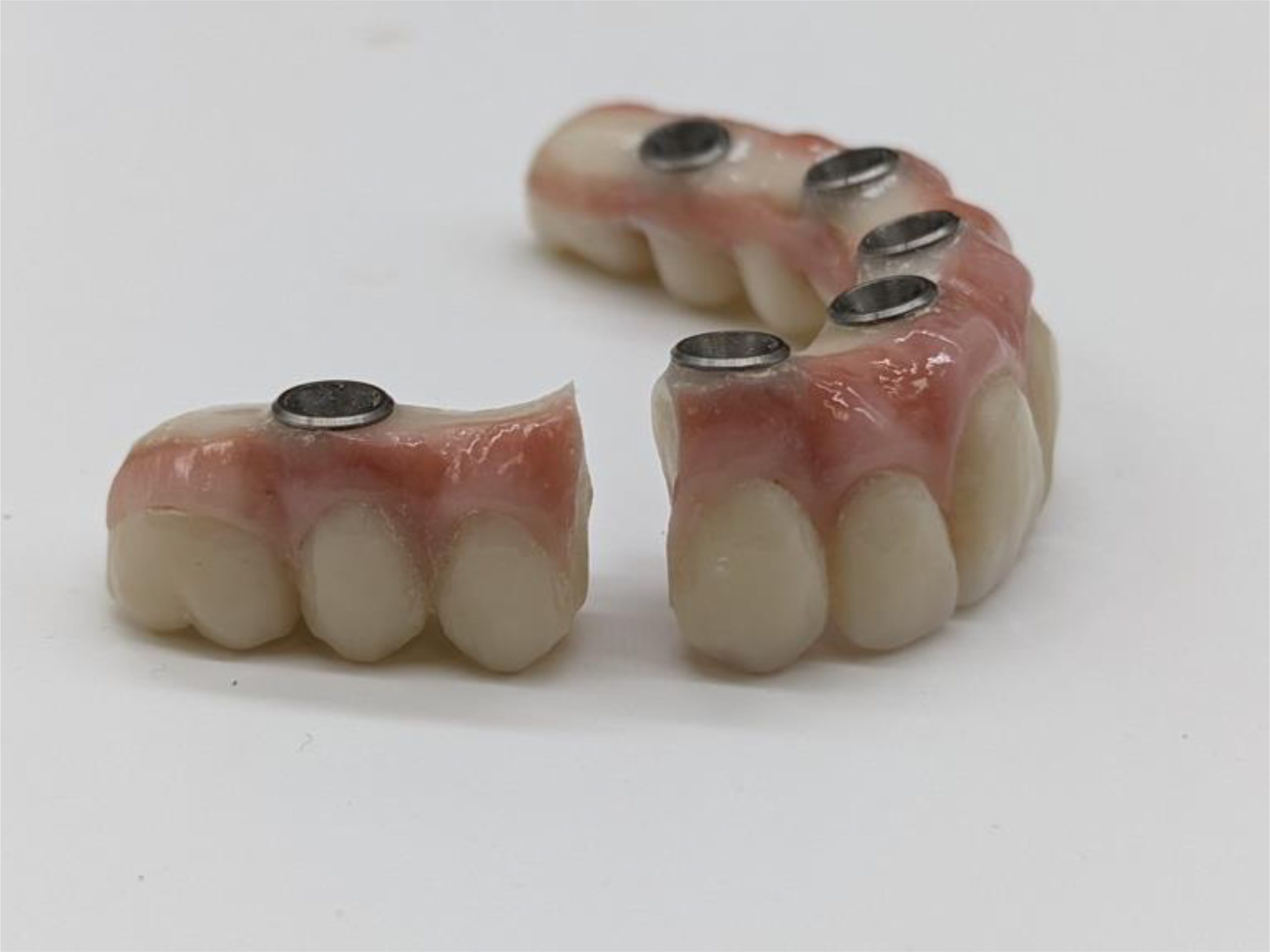functional occlusion