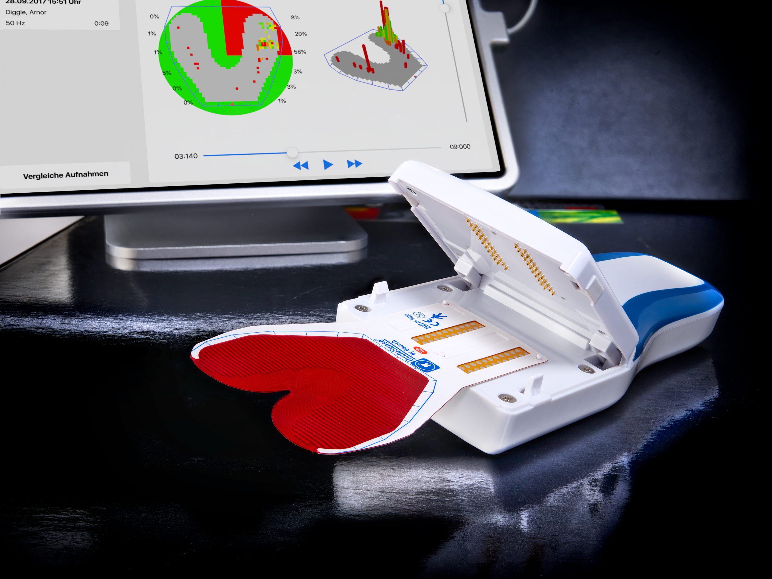 Occlusense occlusal measurement technology