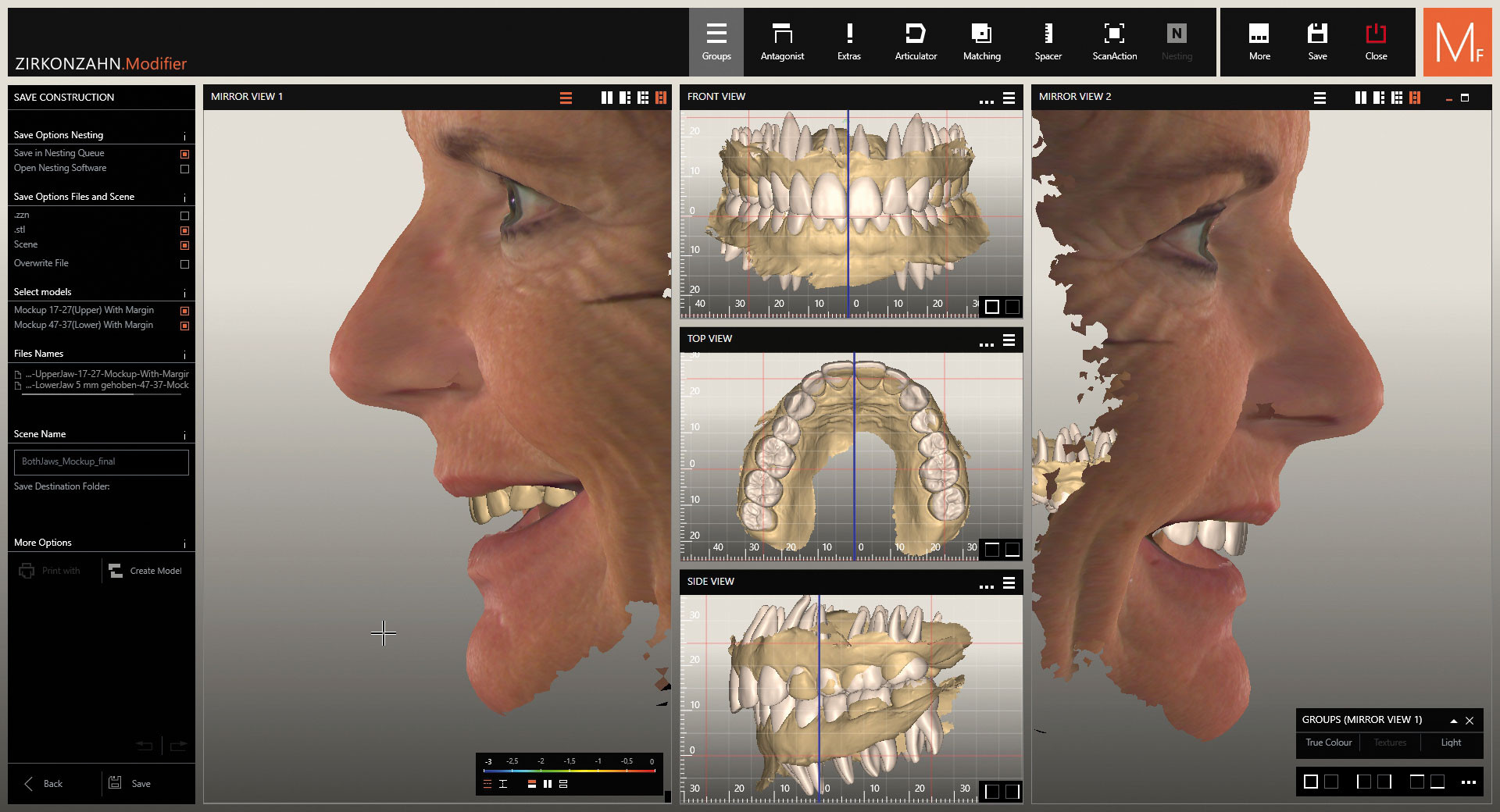 modelling of crowns