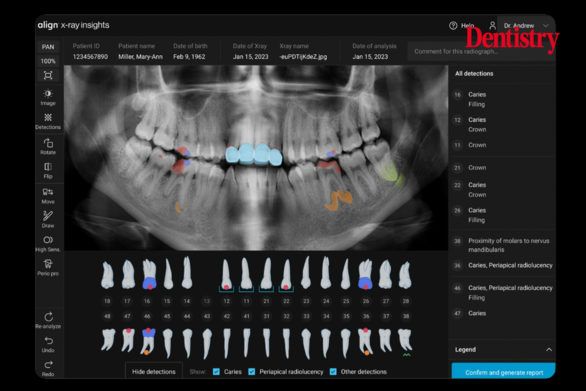 Align oral health suite